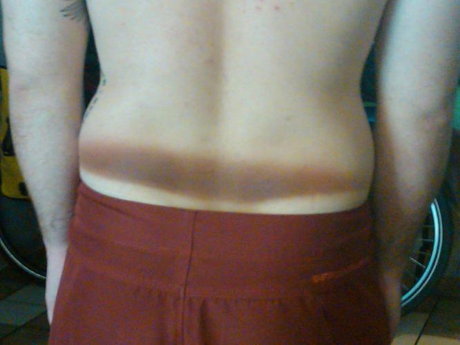 Best tan line ever.